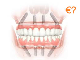Impianto dentale: ricostruzione dente costo a Budapest, Ungheria
